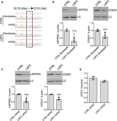 Human induced pluripotent stem cells (hiPSCs) derived cells reflect tissue specificity found in patients with Leigh syndrome French Canadian variant (LSFC)